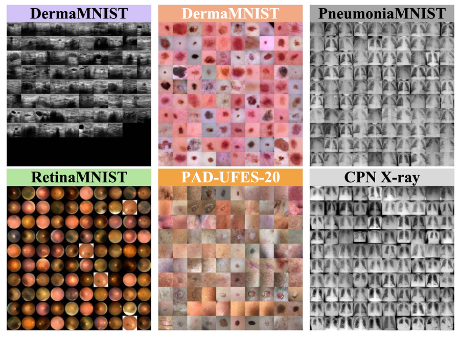 Learning class-conditional temperature teaser